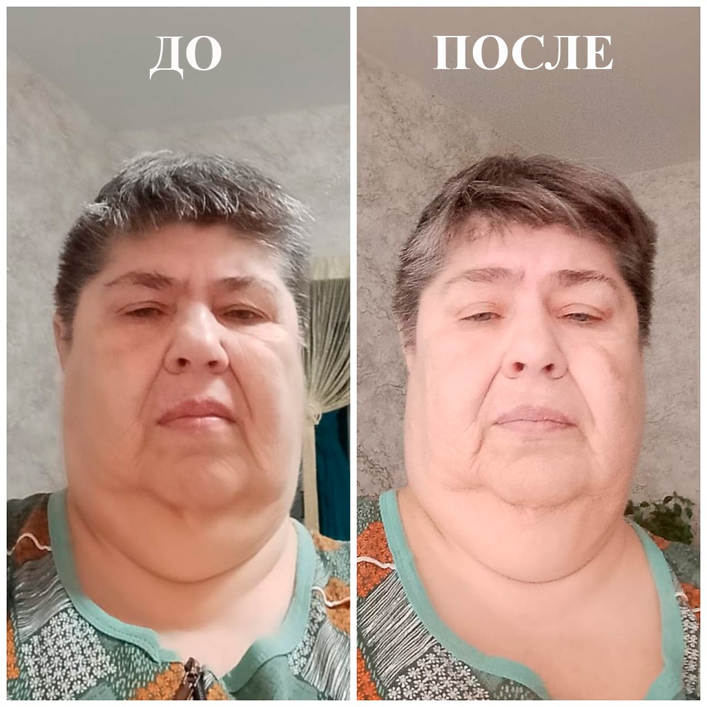 чудеса похудения